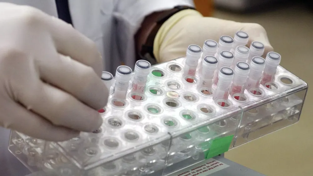 BİLİM İNSANLARINDAN YENİ BİR PROTEİN KEŞFİ